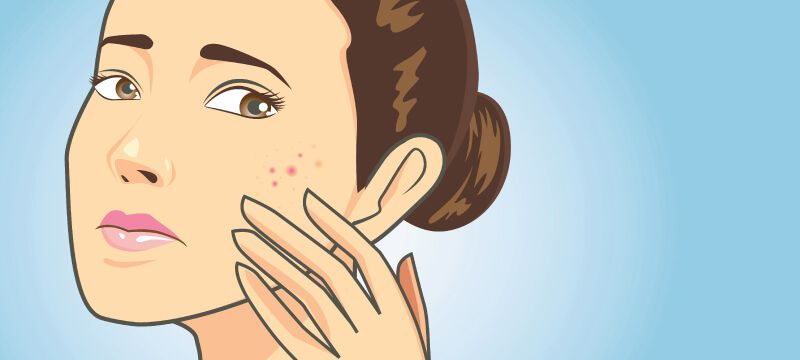 popping a pimple