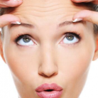 example forhead lines