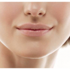 lip filler