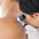 mohs surgery