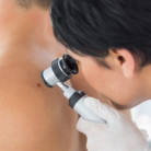 mohs surgery
