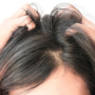 scalp woman