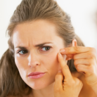 concerned woman looking at acne pimple on face