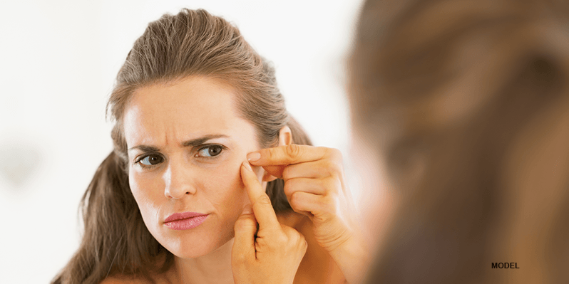 woman inspecting acne on face in the mirror